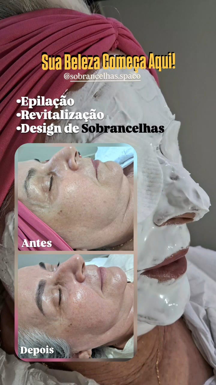Antes e depois de revitalização facial